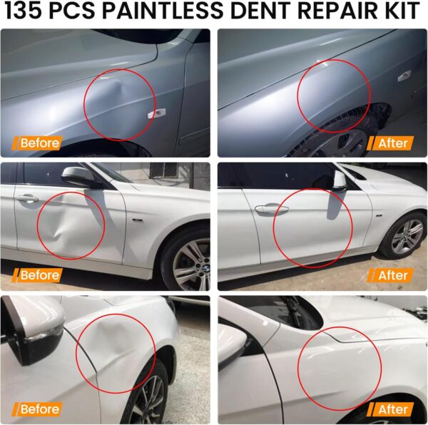 Paintless Dent Removal Kit