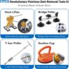 Dent Puller Kit