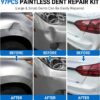 Dent Puller Kit