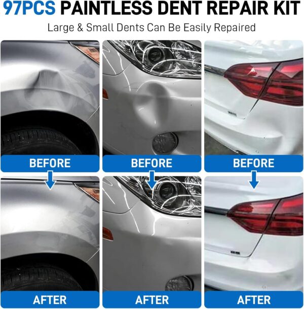 Dent Puller Kit